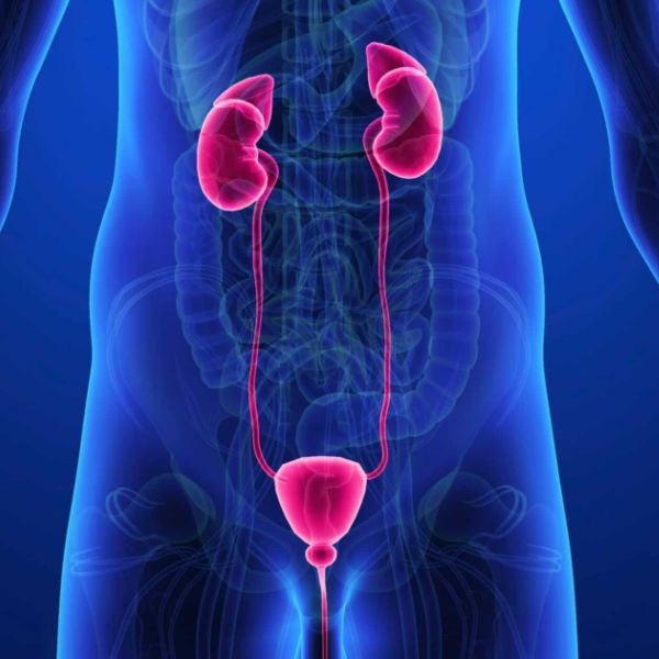 Urolithiasis or Nephrolithiasis (Urinary Tract Stones) – Navyug Hospital